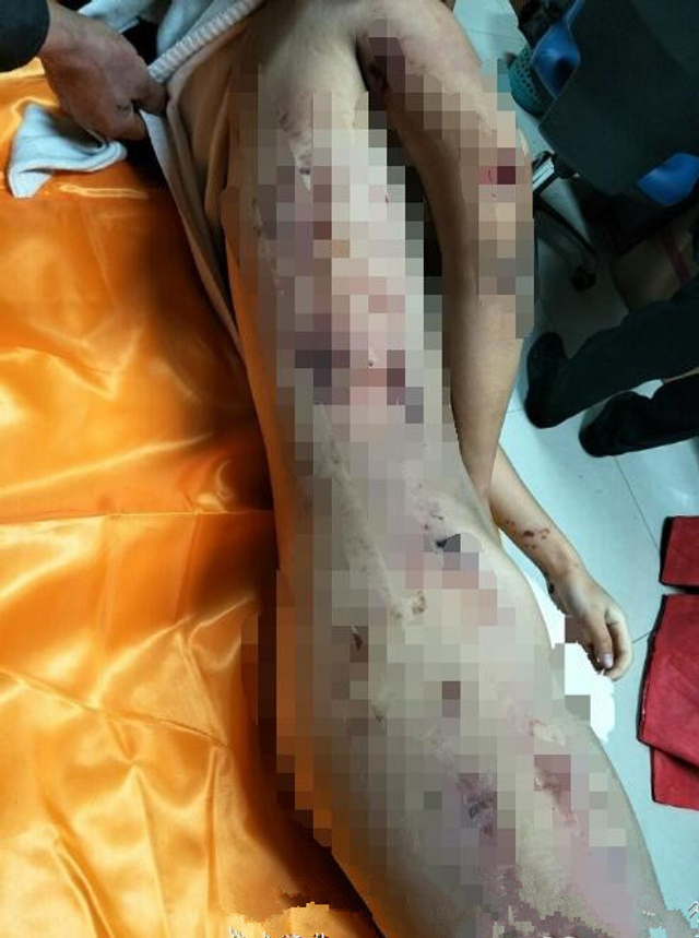济南女大学生裸体坠楼身亡 尸体满身伤痕