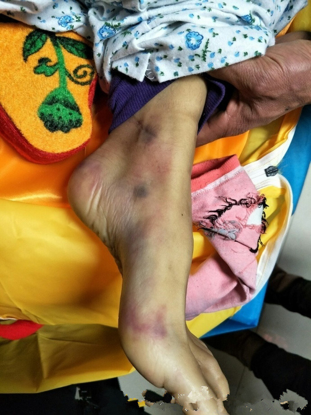 济南女大学生裸体坠楼身亡 尸体满身伤痕