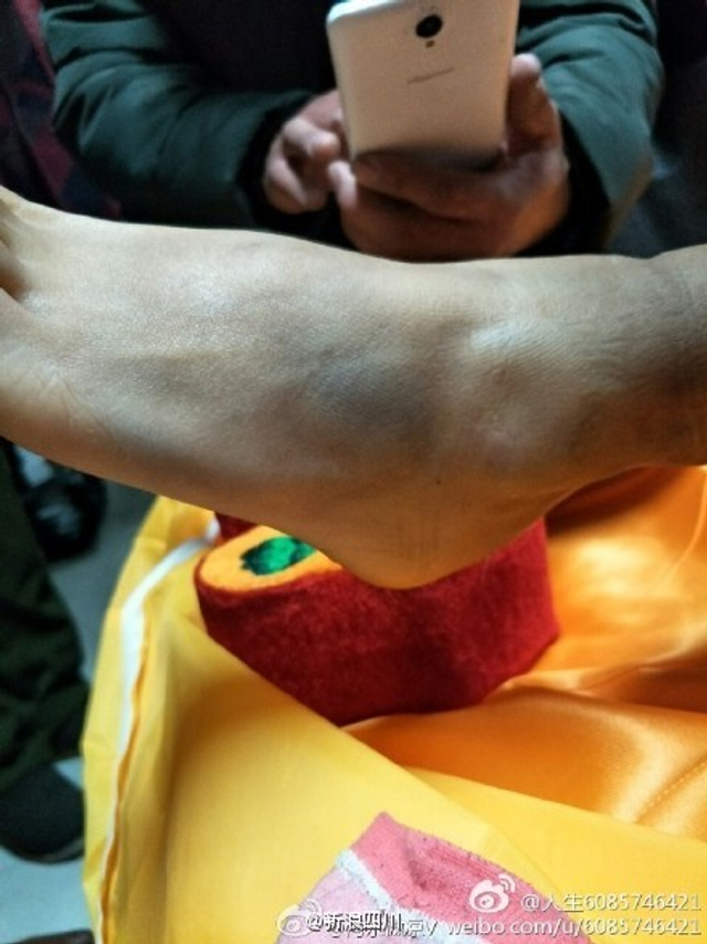 济南女大学生裸体坠楼身亡 尸体满身伤痕