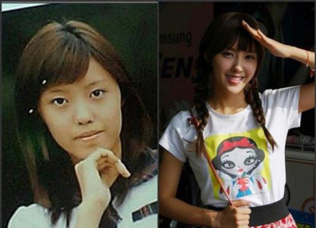 真人出镜：韩国整容前后对比照