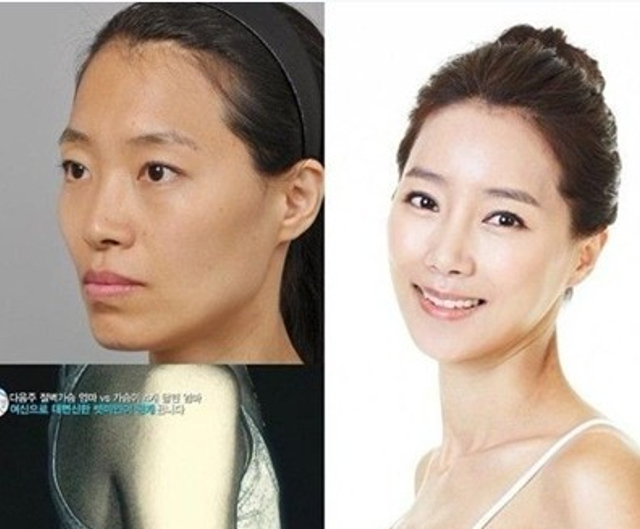 真人出镜：韩国整容前后对比照