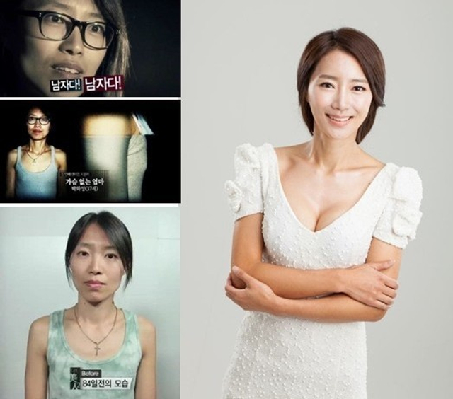 真人出镜：韩国整容前后对比照