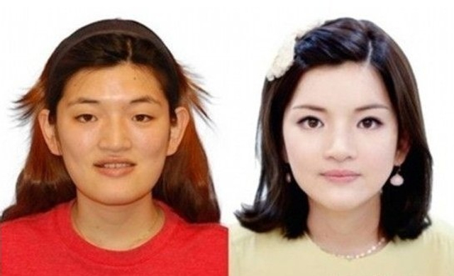 真人出镜：韩国整容前后对比照