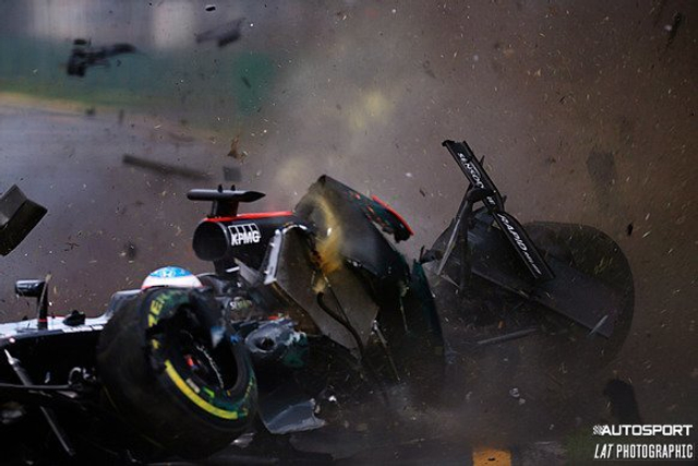 阿隆索发生严重撞车事故