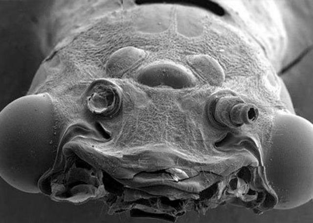 眼虫在显微镜下的图片图片