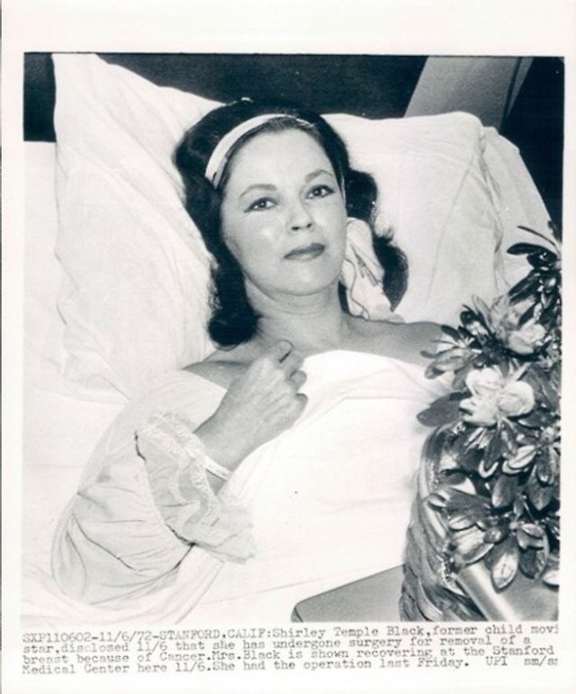 70年代初罹患乳腺癌，勇敢战胜病魔。