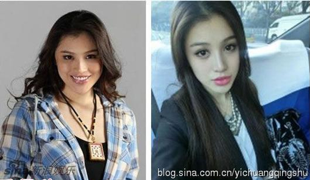 照片差距大被疑整容