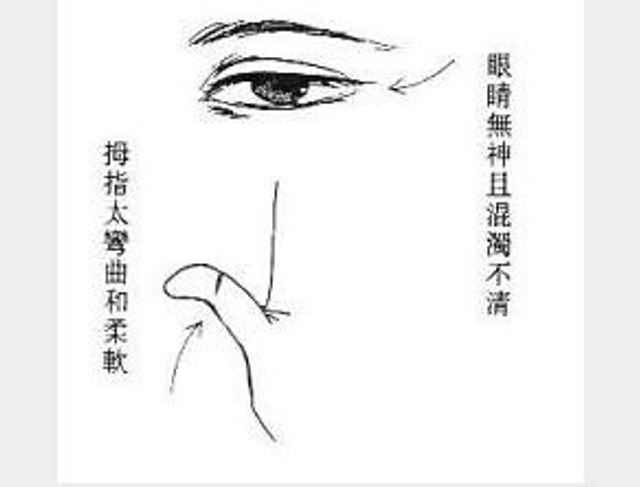 眼睛无神，拇指过弯