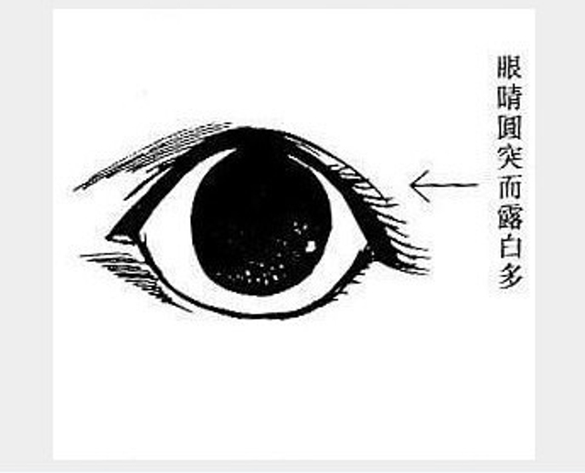 眼睛圆露白多
