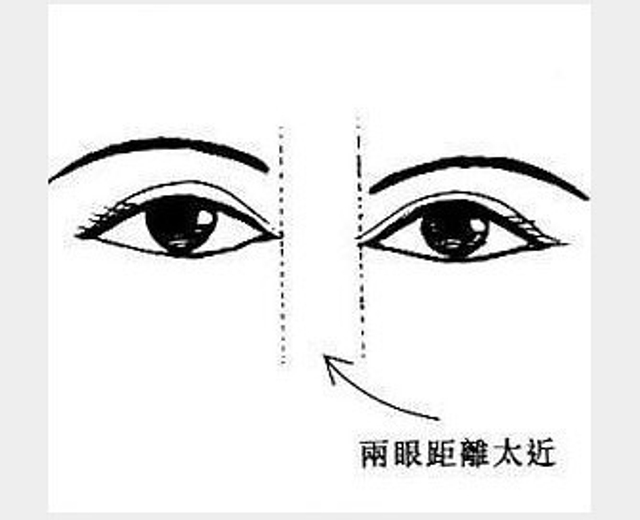 两眼距离太近