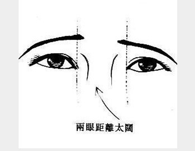两眼距离太阔