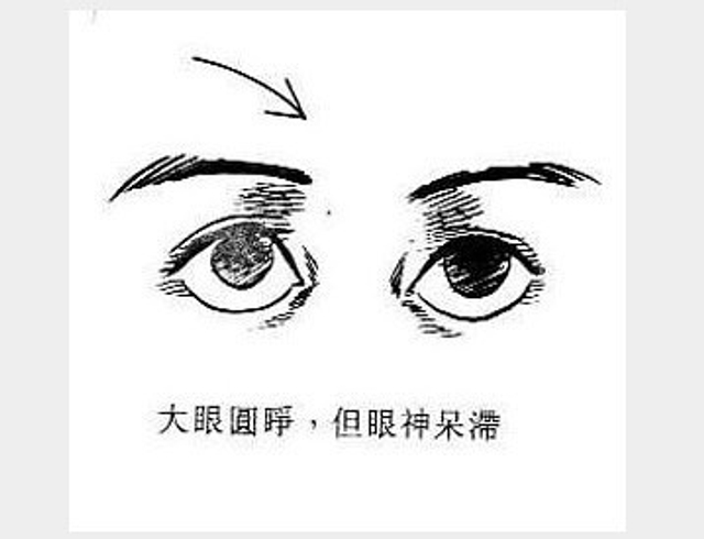 大眼圆睁，神情呆滞
