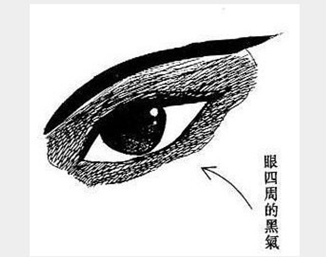 眼四周有黑气