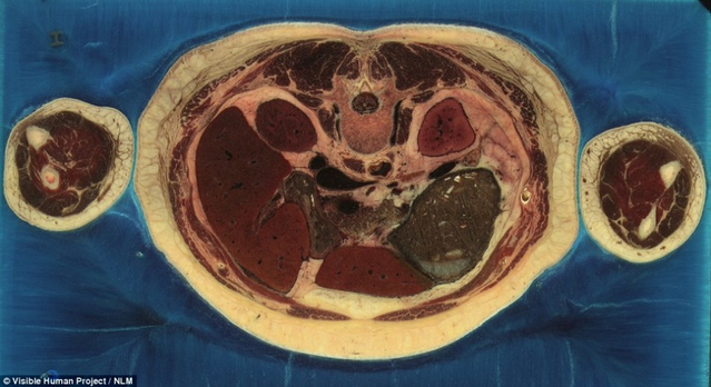 切成了5000个切片并进行扫描,从而建立起一个线上复原的实感人体模型