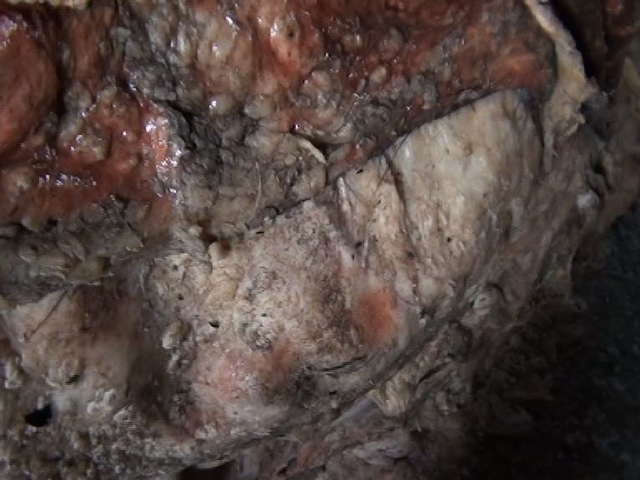 雅客金冠蜡笔小新使用垃圾皮料明胶生产糖果